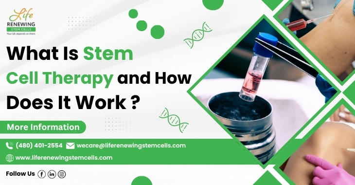 What Is Stem Cell Therapy and How Does It Work?