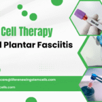How Stem Cell Therapy Helps Heal Plantar Fasciitis Naturally