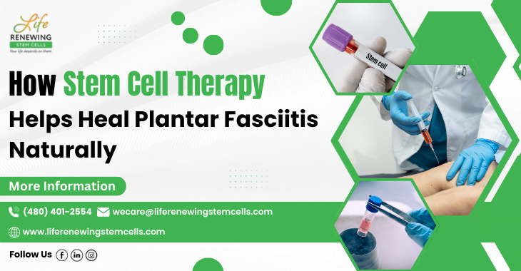 How Stem Cell Therapy Helps Heal Plantar Fasciitis Naturally