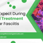 What To Expect During Stem Cell Treatment For Plantar Fasciitis