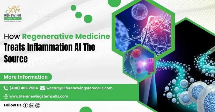 How Regenerative Medicine Treats Inflammation At The Source